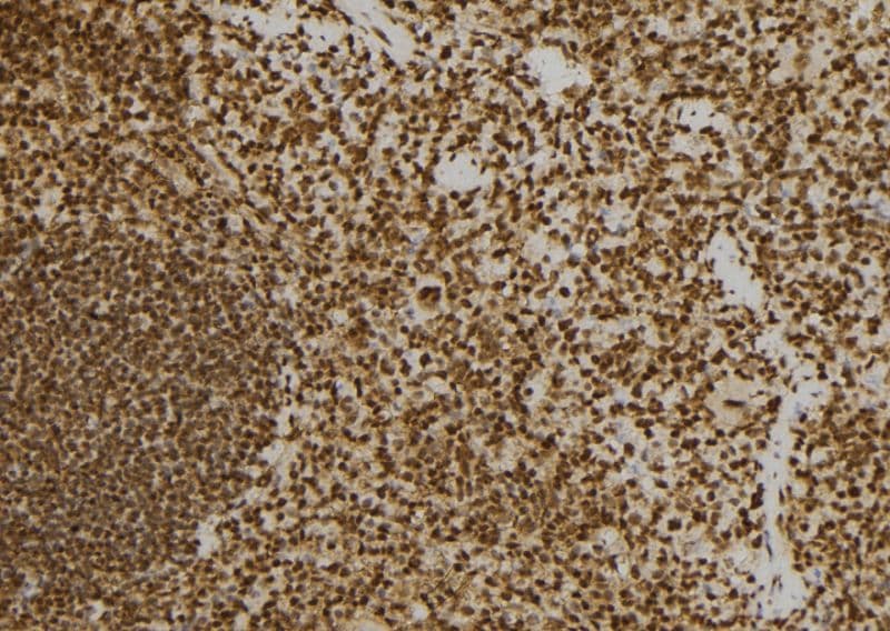 PRKRA / PACT Antibody