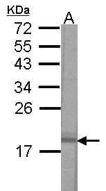 IHC-plus™ VAMP2 / VAMP-2 Antibody (aa1-66)
