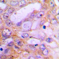 CASP12 / Caspase 12 Antibody (Internal)