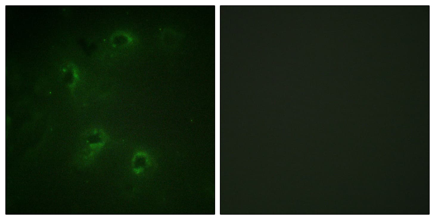 IHC-plus™ DAPK1 / DAP Kinase Antibody (aa274-323)