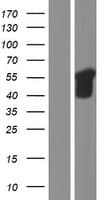 Human SQSTM1 Protein (Over-Expression Lysate Myc-DDK (Flag))