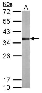 Polyclonal Rabbit anti-Human Rhodanese / TST Antibody (aa1-270, IHC, WB)
