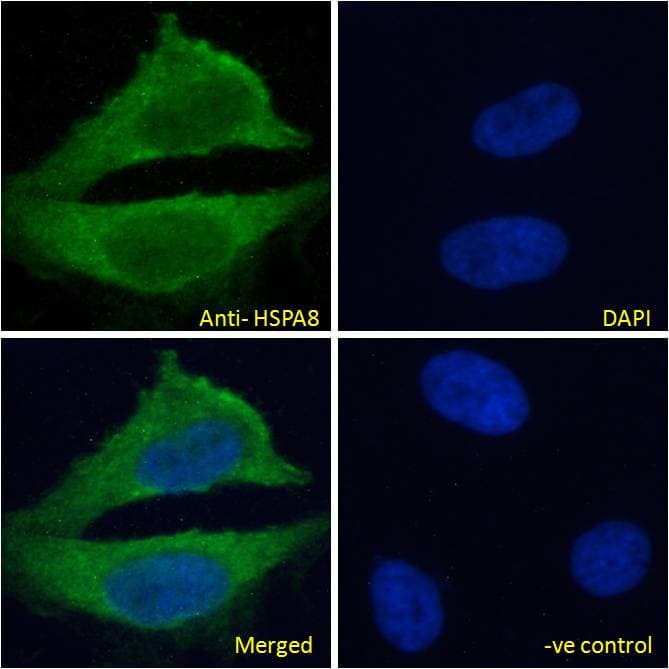 IHC-plus™ HSPA8 / HSC70 Antibody (Isoform 1)