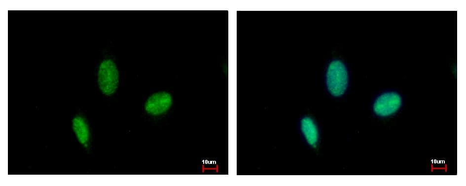 IHC-plus™ Polyclonal Rabbit anti-Human RAD23B / HR23B Antibody (IHC, IF, WB)