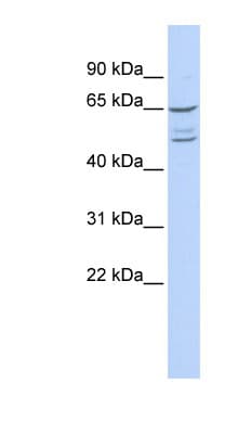 ZNF415 Antibody (N-Terminus)