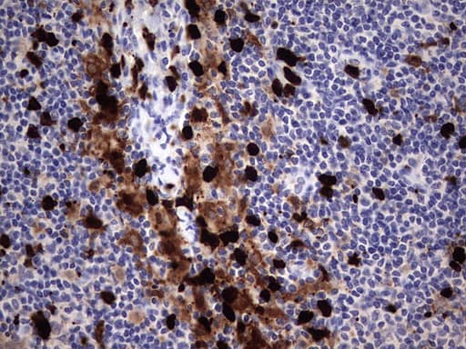 S100A9 / MRP14 Antibody (clone OTI8G1)