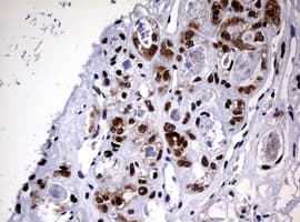Monoclonal Mouse anti-Human NBN / Nibrin Antibody (clone OTI2G4, IHC, WB)