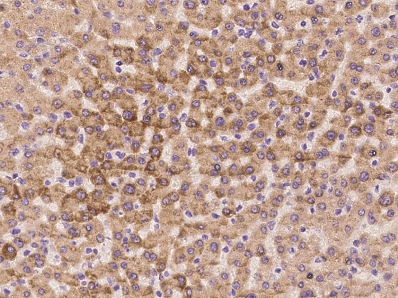 Polyclonal Rabbit anti-Human RPL37A Antibody (IHC)