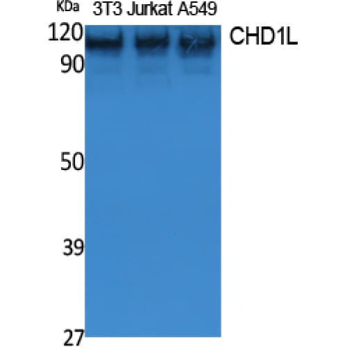 CHD1L Antibody (Internal)