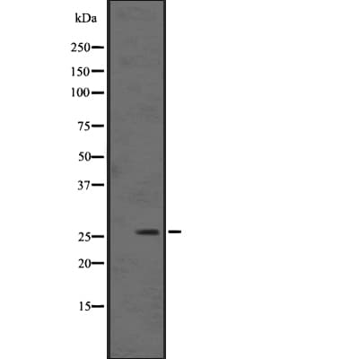 Polyclonal Rabbit anti-Human KLK12 / Kallikrein 12 Antibody (IHC, WB)
