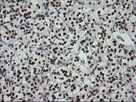 ZSCAN18 / ZNF447 Antibody (clone OTI1F10)