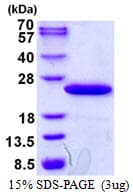 Human TPRKB Protein (Recombinant His)