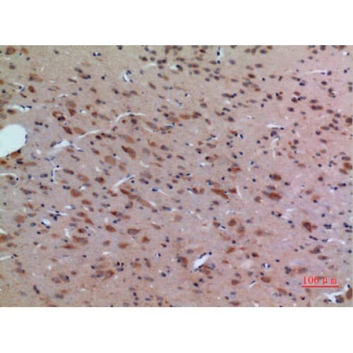 Polyclonal Rabbit anti-Human ABL2 Antibody (591-640 aa, Internal, IHC, WB)