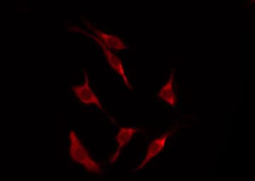 STK11 / LKB1 Antibody (phospho-Thr189)