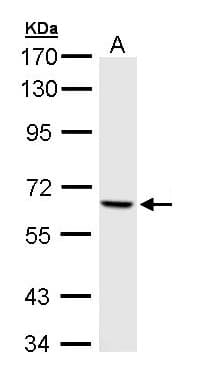 IHC-plus™ Polyclonal Rabbit anti-Human PAK1 Antibody (IHC, WB)