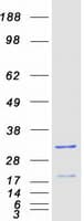 Human SNX10 Protein (Recombinant Myc-DDK (Flag))