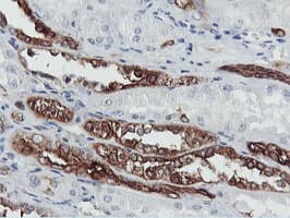 PFKP Antibody (clone OTI1A11)