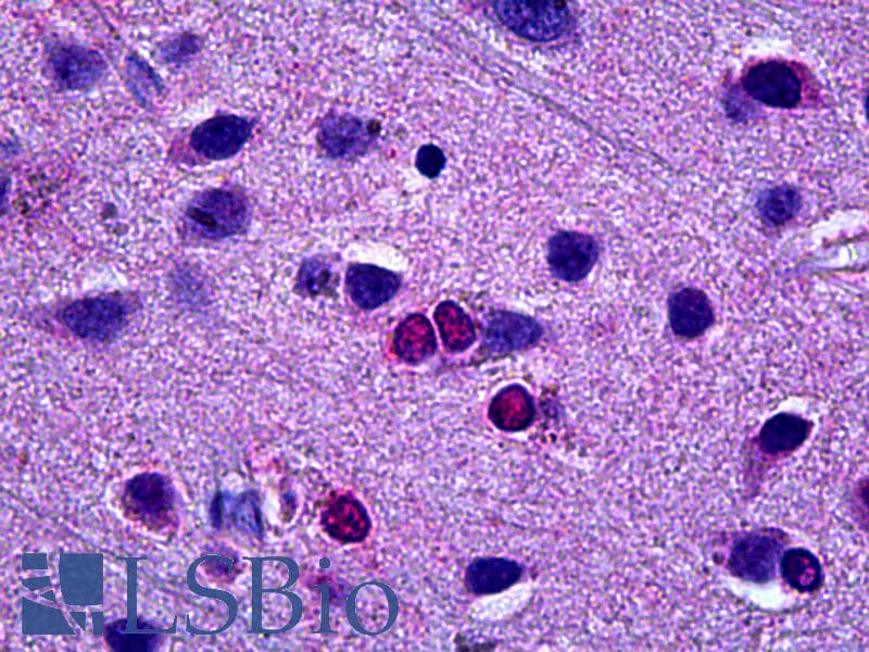 IHC-plus™ Monoclonal Mouse anti-Human EBF3 / COE3 Antibody (clone 8D6, IHC, WB)