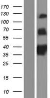 T1R1 / TAS1R1 Protein (Over-Expression Lysate Myc-DDK (Flag))