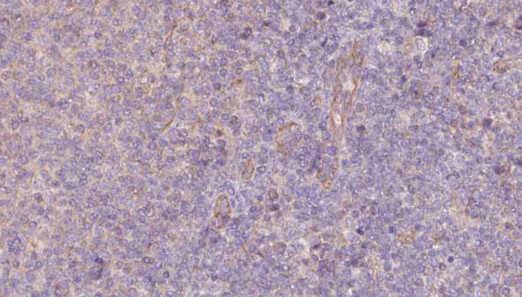 VIPERIN / RSAD2 Antibody