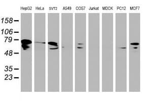 DTNB / Dystrobrevin Beta Antibody (clone OTI3H8)