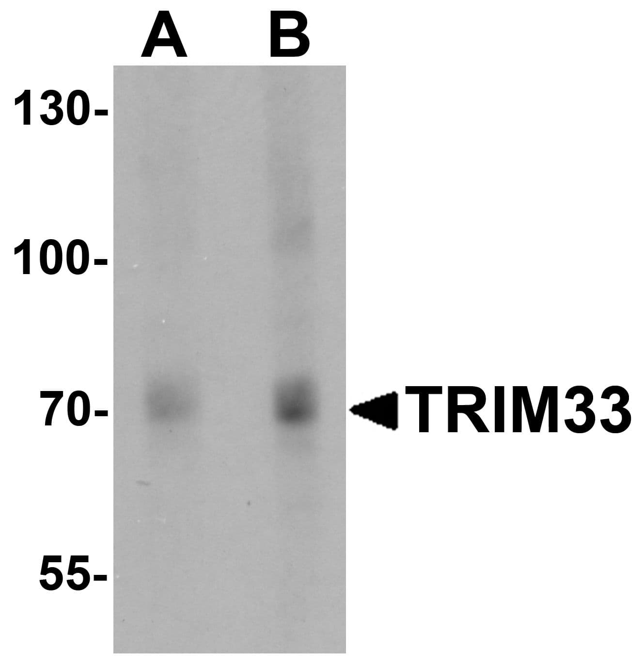 IHC-plus™ TRIM33 / TIF1-Gamma Antibody