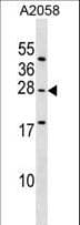 Polyclonal Rabbit anti-Human EPDR / EPDR1 Antibody (aa133-161, WB)