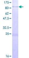 Human Harmonin / USH1C Protein (Recombinant GST)