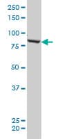 GLNRS / QARS Antibody (clone 5F5)