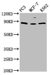 Polyclonal Rabbit anti-Human TRIM28 / KAP1 Antibody (IHC, WB)
