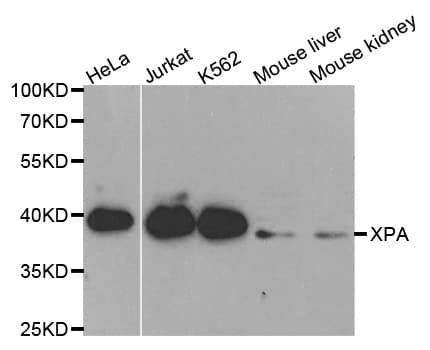 XPA Antibody