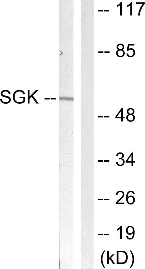 SGK1 / SGK Antibody (p422)