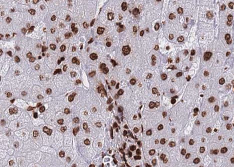 HDAC8 Antibody (phospho-Ser39)