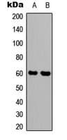 SYT1 / Synaptotagmin Antibody (Internal)