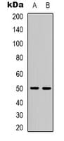 Polyclonal Rabbit anti-Human PPP4R2 Antibody (Internal, WB)