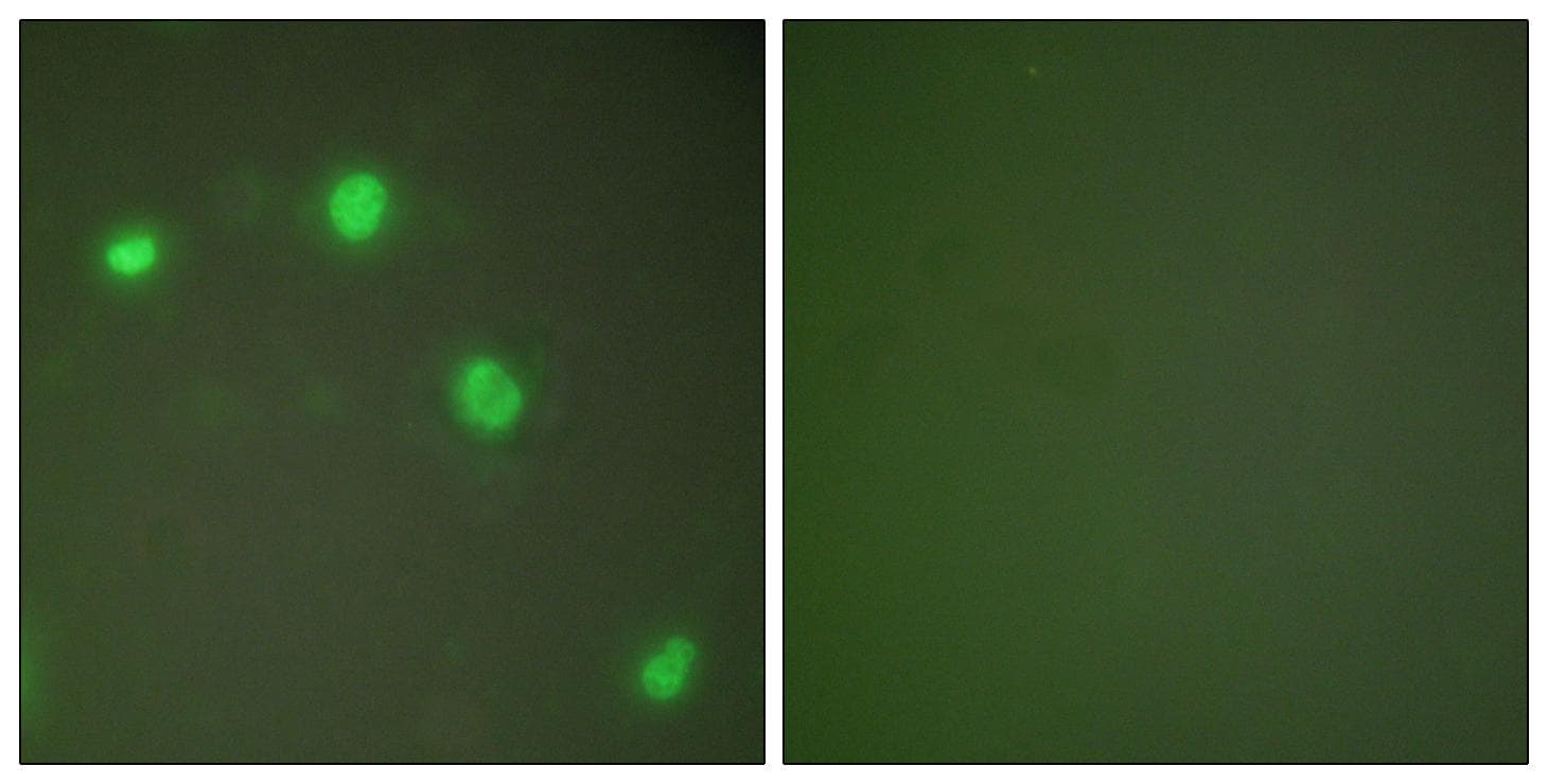 XRCC6 / Ku70 Antibody