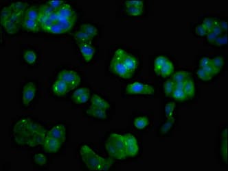 MAST3 Antibody