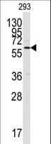 CAMK2A / CaMKII Alpha Antibody (aa446-478)