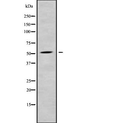 RASGEF1C Antibody