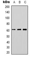 Polyclonal Rabbit anti-Human DOK1 Antibody (Internal, IHC, IF, WB)