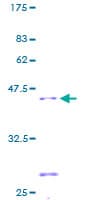 Human SDHC Protein (Recombinant GST)