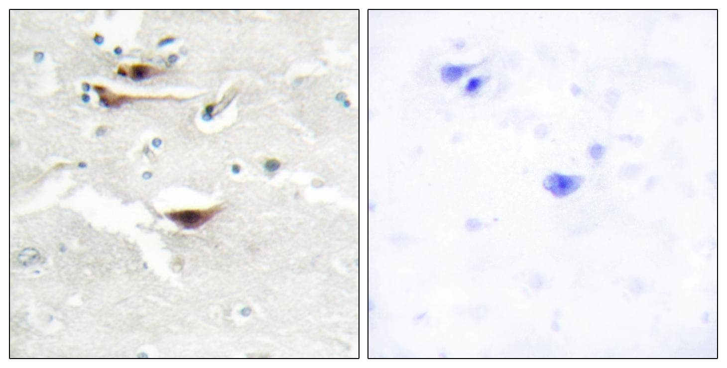 IPPK Antibody