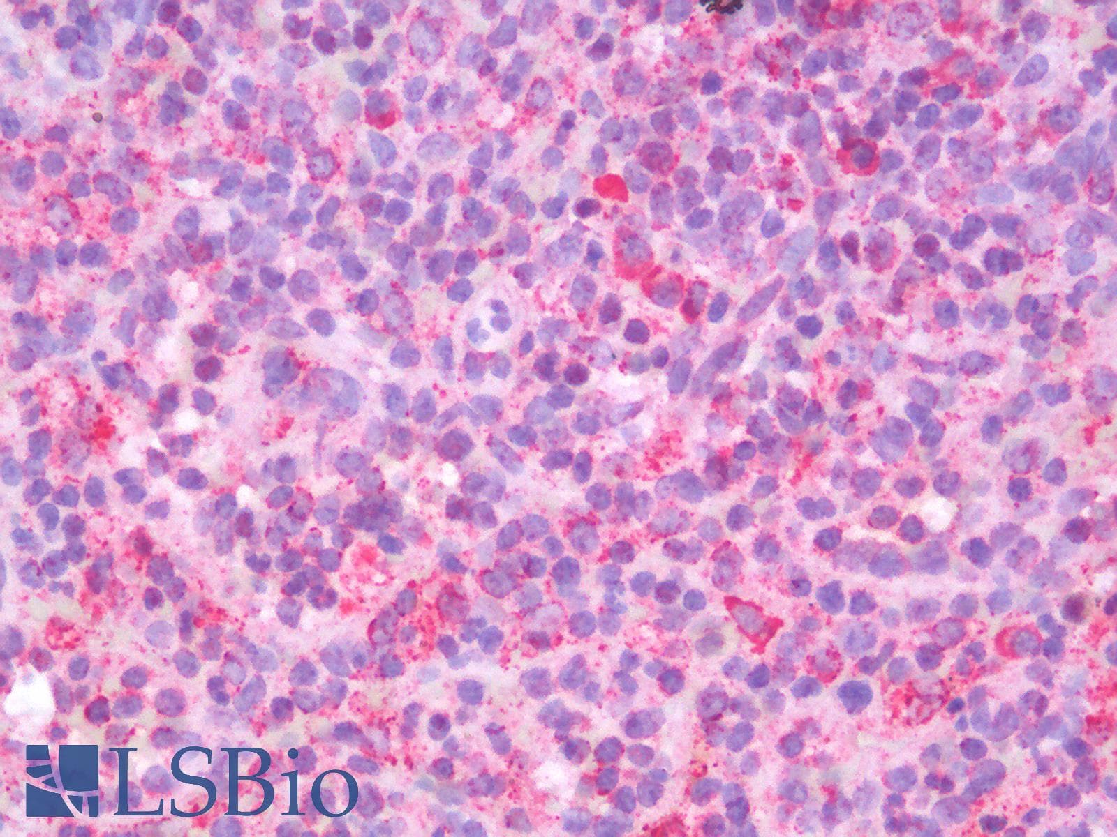 IHC-plus™ HSPA5 / GRP78 / BiP Antibody