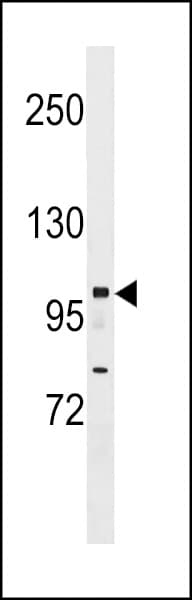NRIP1 / RIP140 Antibody (aa586-613)