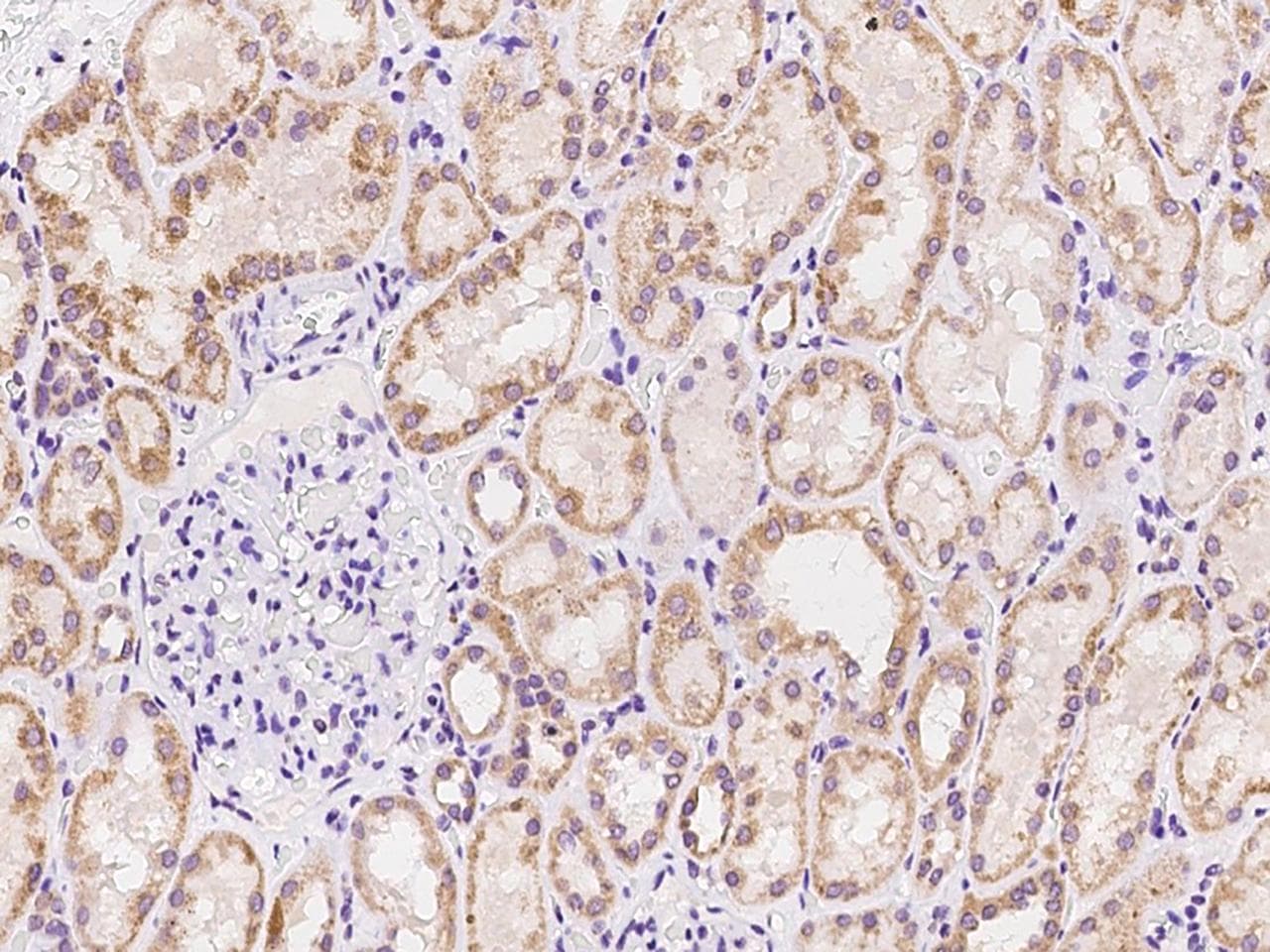 ADCY7 / Adenylate Cyclase 7 Antibody