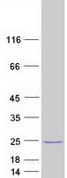 Human OMP Protein (Recombinant Myc-DDK (Flag))