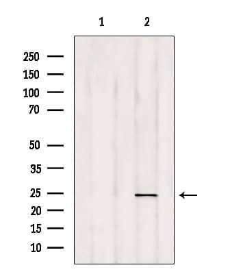 RAB35 Antibody