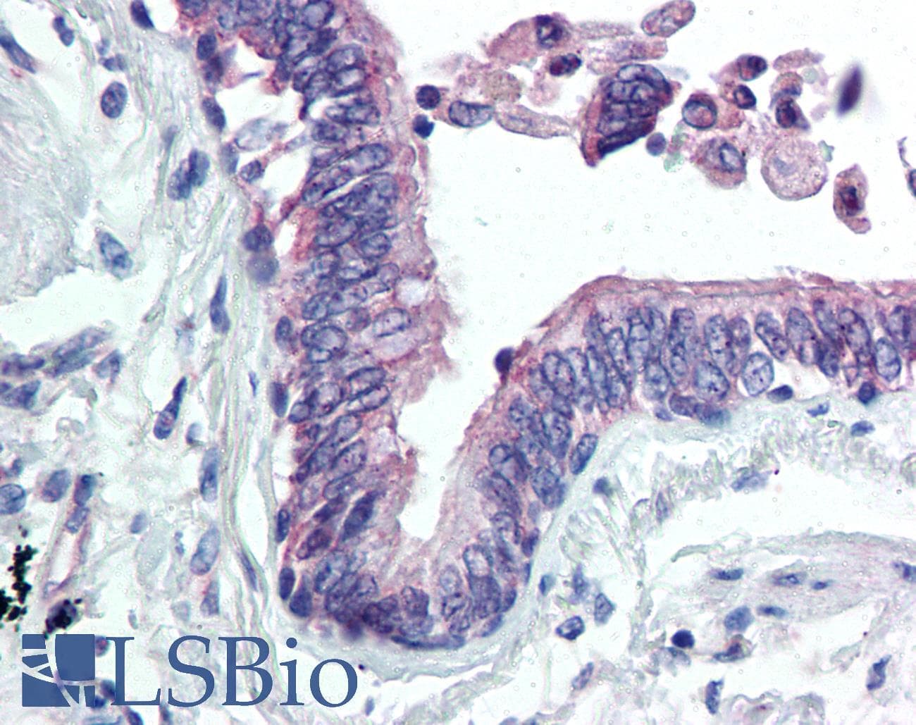CLIC4 Antibody (N-Terminus)