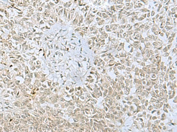 FOXQ1 Antibody