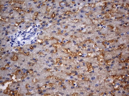 Monoclonal Mouse anti-Human RIPK3 / RIP3 Antibody (clone OTI3A3, aa233-518, IHC, WB)
